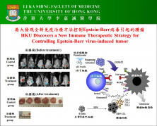 港大發現全新免疫治療方法控制Epstein-Barr病毒引起的腫瘤